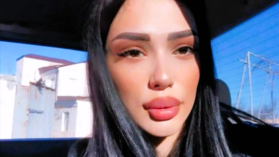 Model (22) stirbt bei Po-Vergrößerung! Tragischer Tod bei Operation, sie wollte noch schöner sein!